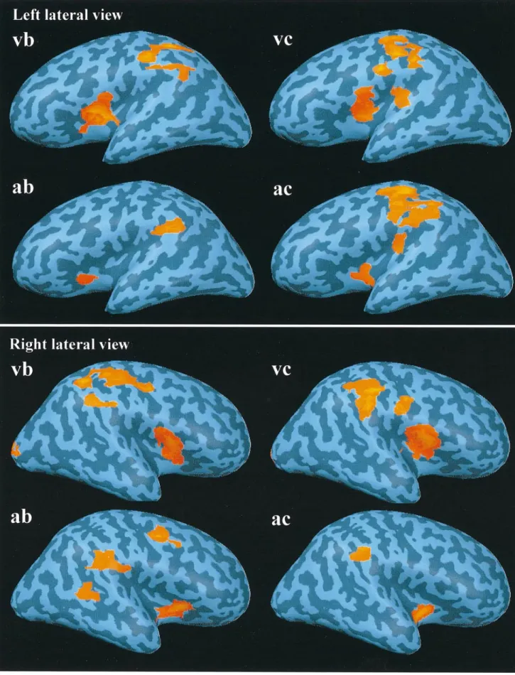 Figure 2. Average (n = 5) three-dimensional maps of BOLD signal increase for targets versus non-targets in all stimulation and response modalities superimposed on the inflated hemispheres of a single subject (see Materials and Methods)