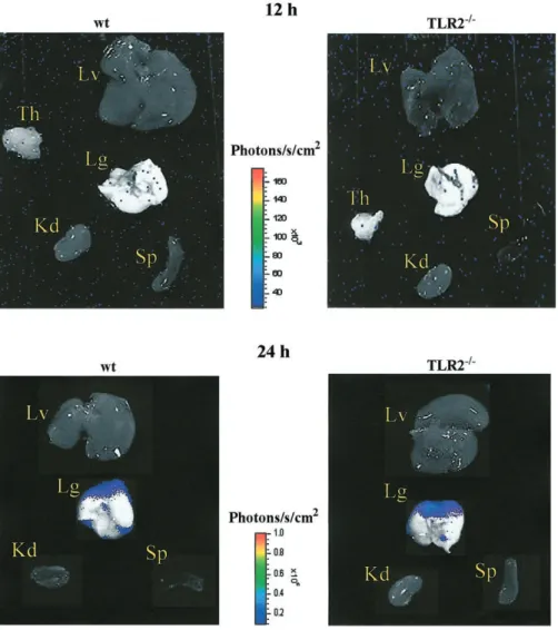 Figure 3. Emitted photons by luciferase-tagged Streptococcus pneumoniae in several organs from wild-type (wt) and Toll-like receptor-2–deficient (TLR2 ⫺/⫺ ) mice detected by a highly sensitive CCD (charge-coupled device) camera (IVIS imaging system; Xenoge
