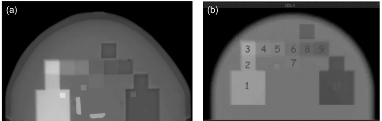 Figure 2. (a) Radiograph of the test phantom using a GE Senographe 2000D digital mammography unit at 28 kV using a Mo–Mo anode–filter combination