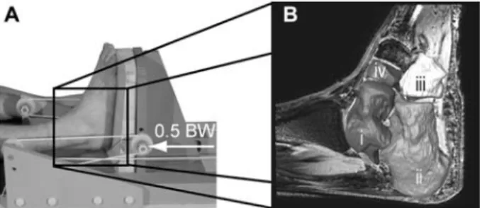 Figure 1 (A) Foot positioning and loading device of the MR imaging procedure. A load of half bodyweight was applied  axi-ally under the heel
