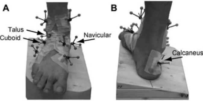 Figure 3 Subtalar joint rotations in response to quasi-static foot (A) pronation and (B) supination.