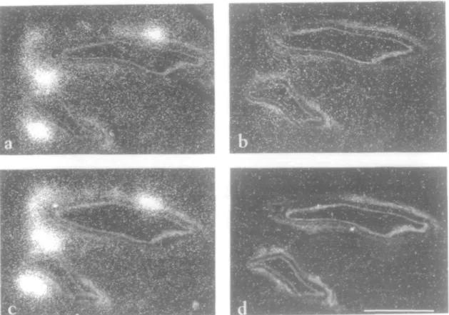 Figure 1 Dark-field micrographs showing the location of Ang II receptor subtypes in rabbit heart parasympathetic nerve cells situated next to intramural coronary arteries