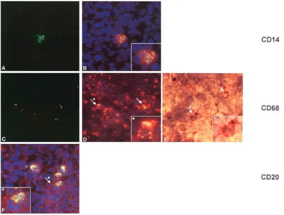 Figure 3. Double-stained sections showing Moraxella catarrhalis associated with macrophages and B cells