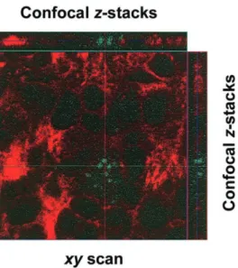 Figure 4. Demonstration of intracellular Moraxella catarrhalis by con- con-focal laser scanning microscopy