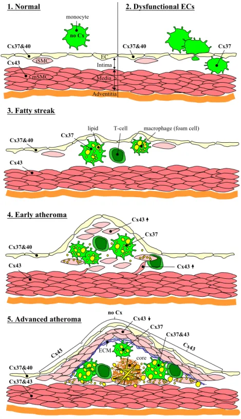 Fig. 2. Altered connexin expression during atherosclerotic plaque development. (1) Normal artery
