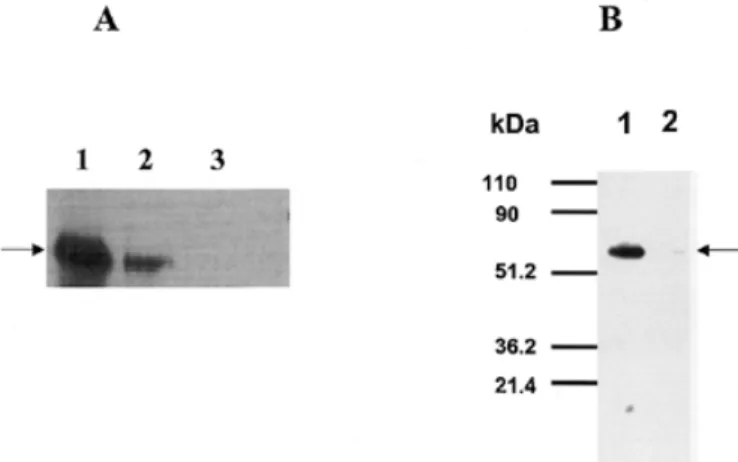 Fig. 5. Expression of His 6 -tagged constructs of SEC59 and hDK1 cDNA in yeast (A) and hDK1 in Sf-9 cells (B) results in the appearance of new polypeptides migrating with an apparent molecular size of 59–60 kDa as judged by SDS–PAGE