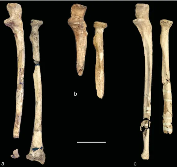 Figure 7. Examples of fresh bone fractures on the left forearm bones (scale-bar = 50mm).