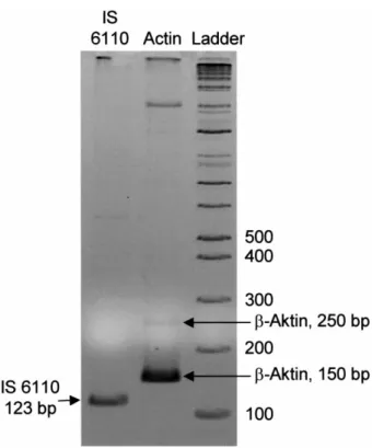 Fig. 2. Gel electrophoretic analysis of PCR ampli®cation products, gener- gener-ated with primers speci®c for IS 6110 and for b-actin (expected product size: 150 bp and 250 bp).