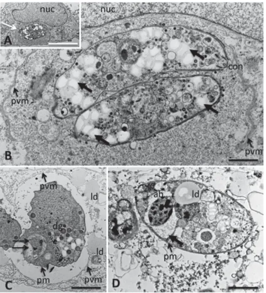Fig. 3. TEM of Neospora caninum tachyzoites grown in HFF and treated with 25 μ M miltefosine for 20 h