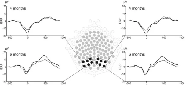 Fig. 2 Grand-average ERP of left and right regions of interest over posterior temporal sites (channels of interest are marked in black)