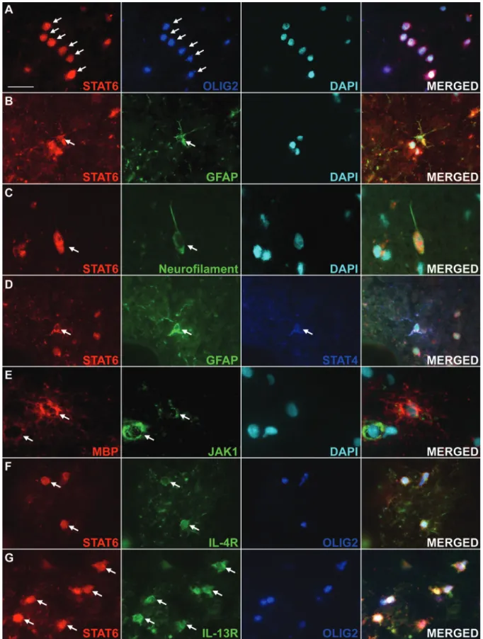 Fig. 4 Immunofluorescence localization of STAT6 and JAK1 in MS NAWM. STAT6 was mostly colocalized together with the oligodendrocytes marker OLIG2 (A)
