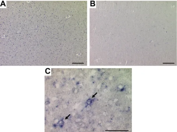 Fig. 5 In situ hybridization of HLA-DR mRNA in MS and control white matter. Many HLA-DRa positive cells were detected in the NAWM of MS cases ( A) compared with white matter from control cases where the hybridization signal was below background levels (B)