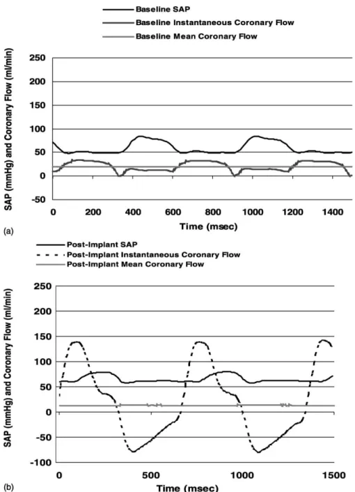 Fig. 3. Instantaneous and mean flow waveforms and systemic arterial pressure (SAP) waveforms before (a); and after (b) implantation of the Bi-DRD.