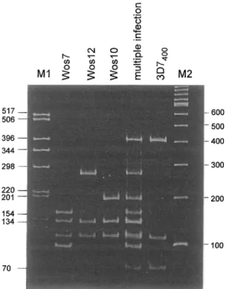 Fig.  2.  HinfI  digest  of  msp2  alleles  of  a Plasmodium  falciparum  multiple  infection  from  a  Tanzanian  blood  sample,  which  shows  a  multiplicity  of  4  concurrent  infections