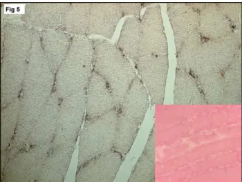 Fig. 5. mRNA expression and localization in the myocytes and macrophages in the M. tibialis anterior of a group B animal by in situ hybridization