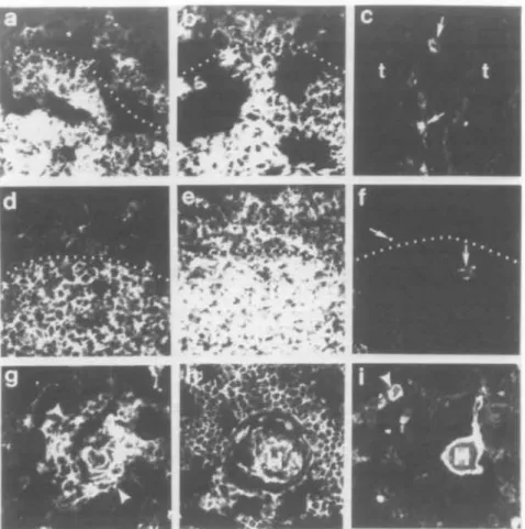 Fig. 2. Ontogeny of expression of CD44 molecules in human fetal thymus. Panels (aHc) show fetal thymus no