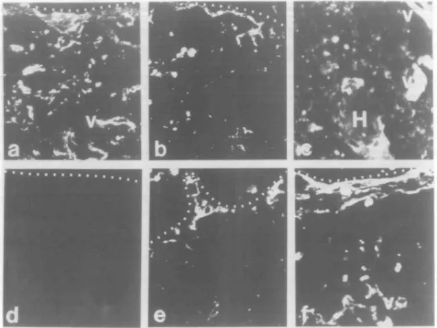 Fig. 9. Ontogeny of CD44 ligands FN and HA during human fetal thymic development. Panels (a)-(c) show reactivity of anti-FN antibody FN15