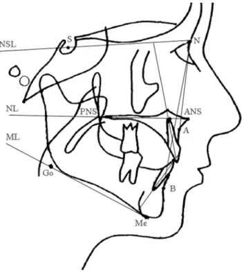 Figure  1  Landmarks  and  reference  lines  used  in  the  cephalometric  analysis. S, sella; N, nasion; ANS, anterior nasal spine; PNS, posterior  nasal spine; A, cephlometric point A; B, cephalometric point B; Me,  menton; Go, gonion; NSL, sella nasion 