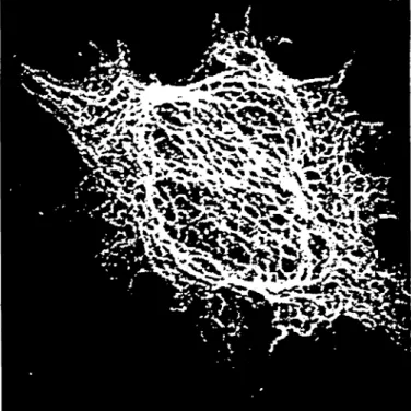 Figure 2: Graph representalion of the skeletonized CLSM Image (Figure 1).