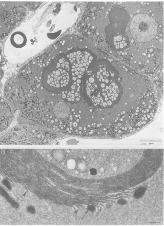 Fig. 3. GGT-poshive, eosinophilic focal tissue from a rat treated for 30 weeks with PB after a single dose of DENA