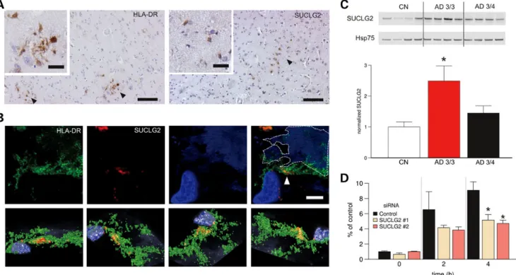 Figure 2. Functional studies of SUCLG2. (A and B) SUCLG2 localized to microglia in AD brains