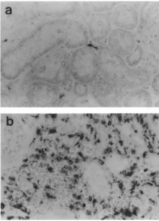 FIGURE 4. Interstitial monocyte-macrophages are occasionally  seen in clipped kidneys of Goldblatt rats (a) and sham controls, but  dense foci are present only in undipped kidneys (b), especially in  areas of tubular damage (x400)