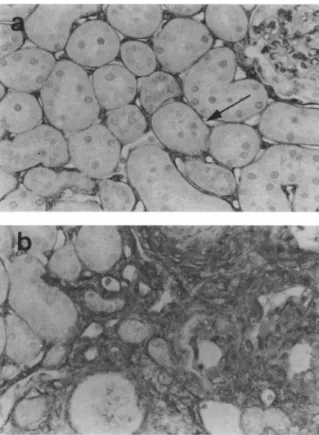 FIGURE 7. Immunostaining for collagen type IV (arrow) in  clipped kidneys (a) and sham controls is seen in the tubular base­