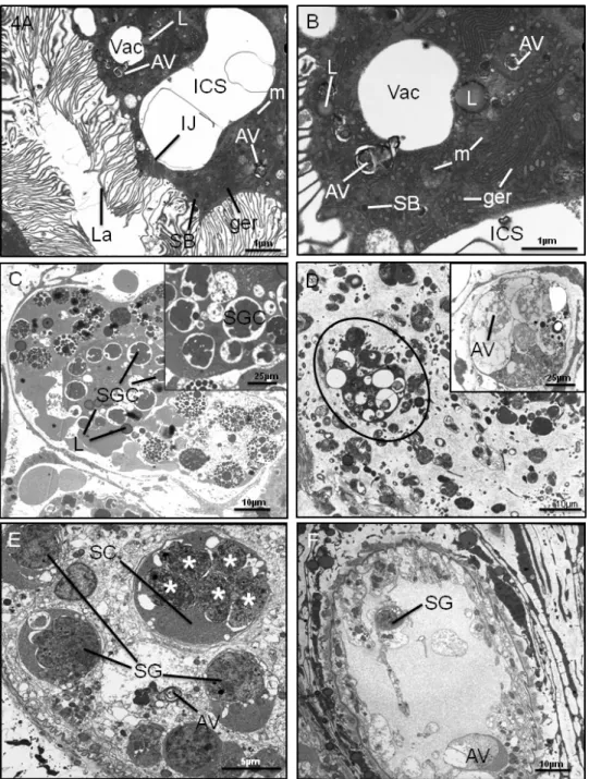Fig. 4. Transmission electron micrographs (TEMs) of adult Fasciola hepatica following 48 h treatment in vitro with OZ78 (100 mg/ml)