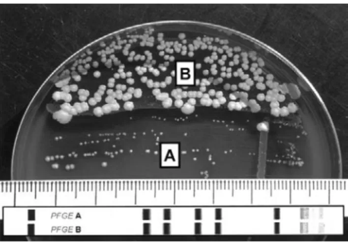 Figure 1. Small colony variant (A) and normal-phenotype Staphylo- Staphylo-coccus aureus (B) isolated from patient 1 on Columbia blood agar.