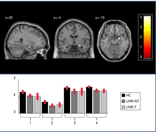 Fig. 1. Cortical thickness differences between the ultra-high risk (UHR) and healthy control (HC) groups: right