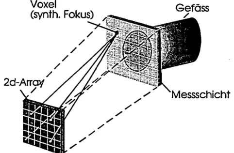 Fig. 3: Schallfeld eines 'groben 1  2d-Arrays (8x8 mit 12mm Kantenlänge, 4 MHz) mit 5.5 Grad elektronischer Strahlauslenkung in Azimuth und Elevation und Fokussierung in 80 mm Distanz