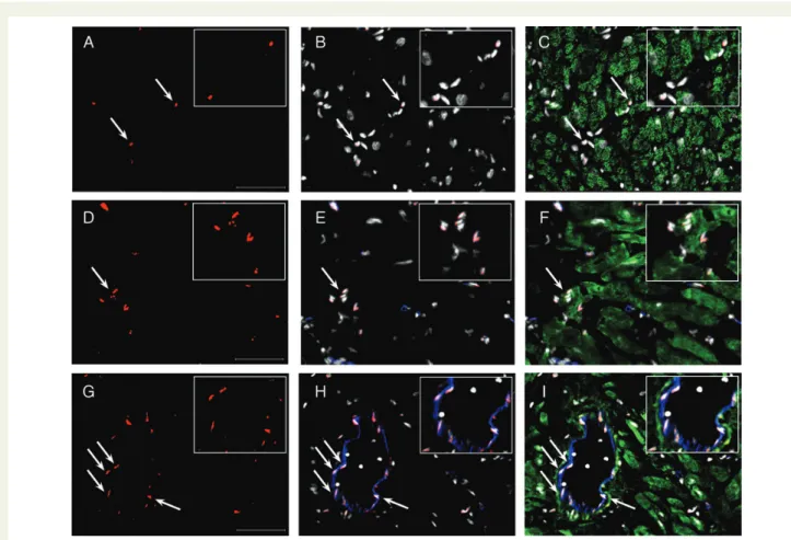 Figure 1 Breast cancer resistance protein + cells in the adult human heart. Cryosections of heart tissue were stained with antibodies to breast cancer resistance protein (red), titin (green), and CD31 (blue)