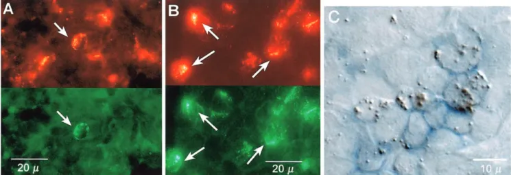 Figure 2. Photo of perforin mRNA– expressing cells in lymphoid tissue in patients with acute human immunodeficiency virus infection (A) or acute Epstein-Barr virus mononucleosis (B)
