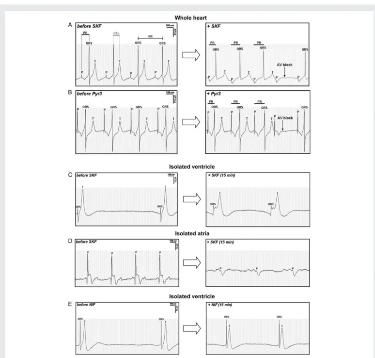 Figure 4 Representative ECG recordings showing the P, QRS and T components of the embryonic heart spontaneously beating ex vivo treated with SKF 40 mM (A) or Pyr3 10 mM (B)