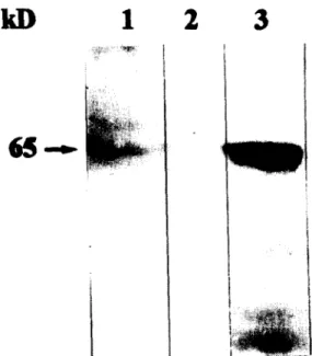 Fig.  4.  Western  blot  analysis  of  total  bacterial  cell  extracts  using  a  polyclonal  antibody  against  the  OadA  of  K