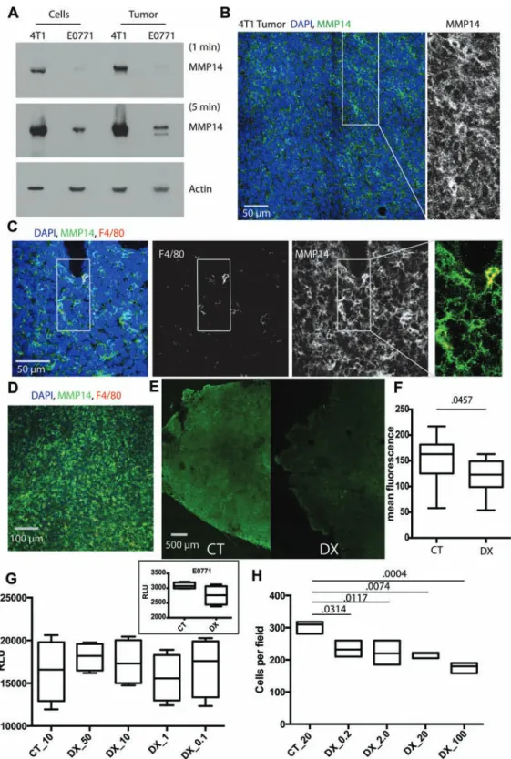 Figure 1.  MMP14 expression and activity in breast cancer in vivo and its direct effects on tumor cells in vitro