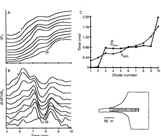 Figure  4  Impulse  conduction  with  multiphasic  action  potential  upstrokes.  Right  bottom  panel  shows an  outline  of  a  strand  (width  20  pm)  emerging  into  a  large  area