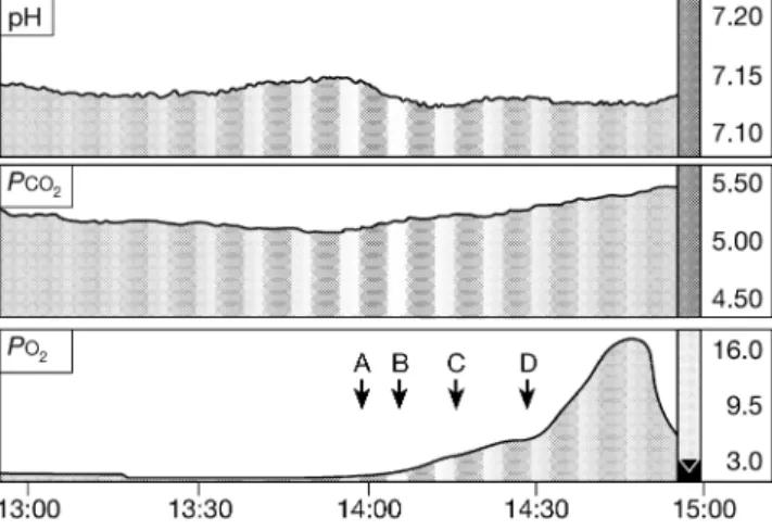 Fig 4 Neurotrend printout showing pH, carbon dioxide and brain tissue oxygen in response to changes in inspired oxygen (F I O 2 ) in a  head-injured patient
