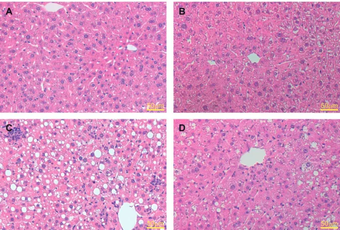 FIG. 3. Representative hematoxylin and eosin stain of the livers after 28 days diet. Both A, AlbCreþ/caNrf2 and B, AlbCreþ/caNrf2þ animals on standard chow demon- demon-strated normal liver histology