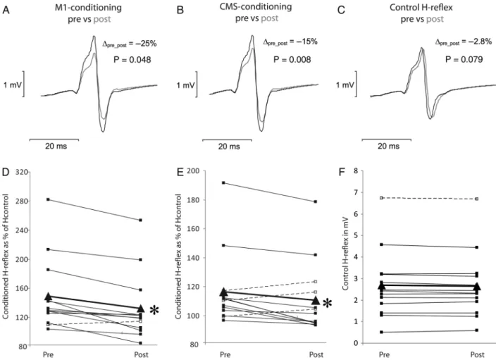 Figure 4. Results from Experiment II. The effects of low-frequency rTMS on the early facilitation obtained with M1-conditioning ( A and D ) and CMS-conditioning ( B and E ).