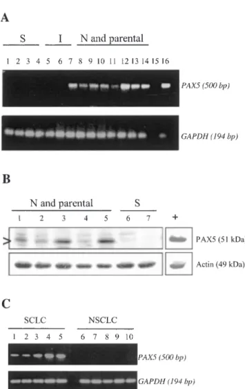 Fig. 1. Expression of PAX5 in neuroblastoma and lung cancer cell lines.