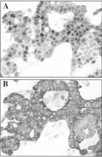 Fig. 4. PAX5 expressing CA-2E cells are capable of growing anchorage- anchorage-independently