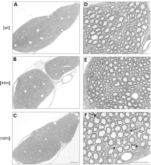 Figure 2. Histological analysis of sciatic nerves. Sciatic nerve cross-sections of wt (A and D), Mtmr2 þ/m (B and E) and Mtmr2 m/m (C and F) mice at 2 months of age