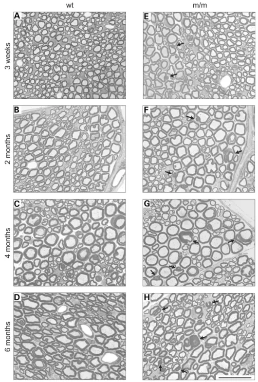 Figure 3. Time course analysis of sciatic nerves. Sciatic nerve cross-sections of wt (A–D) and Mtmr2 m/m (E–H) mice