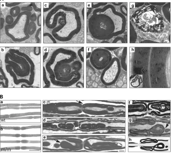 Figure 6. Focally folded myelin in Mtmr2 m/m sciatic nerve. (A) Electron microscopic analysis of sciatic nerves derived from 6-month-old Mtmr2 m/m mice.