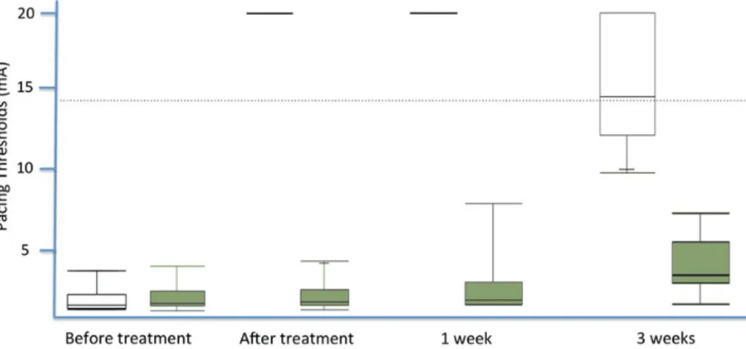Figure 2: Pacing thresholds measured from the atrial wires before and after Cobra Revolution ablation, before discharge, and at 3 weeks.