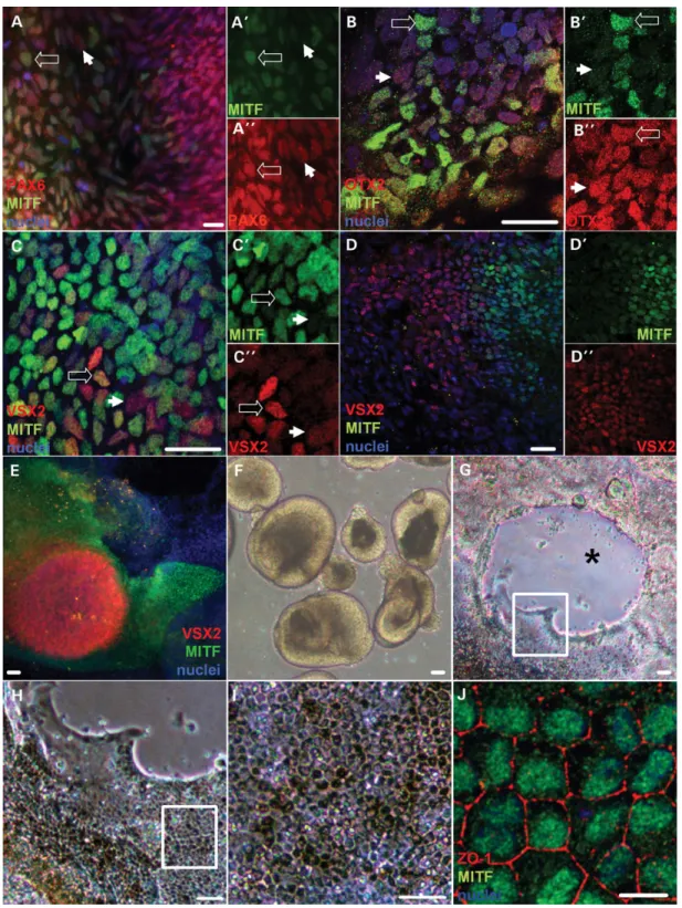 Figure 1. Expression of MITF during early retinal differentiation in hESCs. (A) Immunocytochemistry (ICC) for PAX6 (red) and MITF (green) in adherent hESC cultures differentiated for 13 days