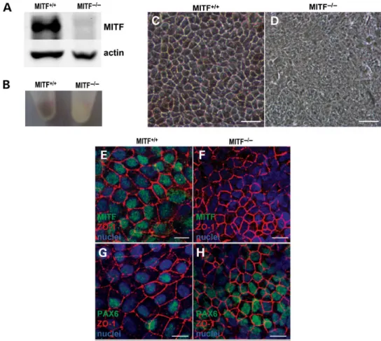 Figure 6. RPE is produced in MITF 2/2 hESCs but develops abnormally. (A) Western analysis for MITF and ACTIN protein in d60 second passage MITF +/+ and MITF 2/2 hESC-RPE
