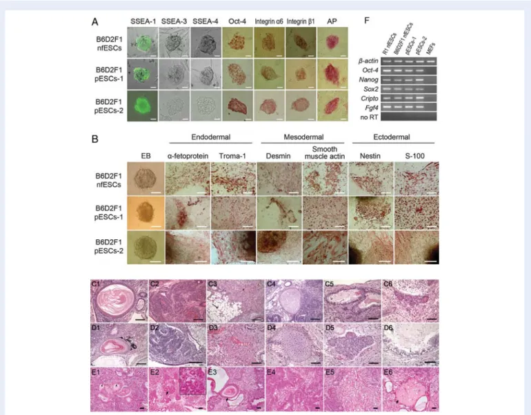 Figure 1 Characterization for two types of mouse ESC that are derived from normal fertilization (nfESCs) and parthenogenesis (pESCs-1 and pESCs-2) of B6D2F1 strain.