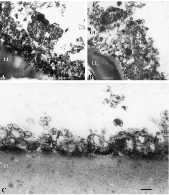Figure 6. Transmission electron microscopy of metacestodes treated with nitazoxanide (A, B) and albendazole (C) for 7 days